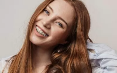 How Much Are Clear Braces – Are They Worth It