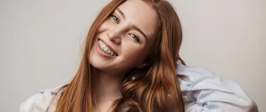How Much Are Clear Braces – Are They Worth It